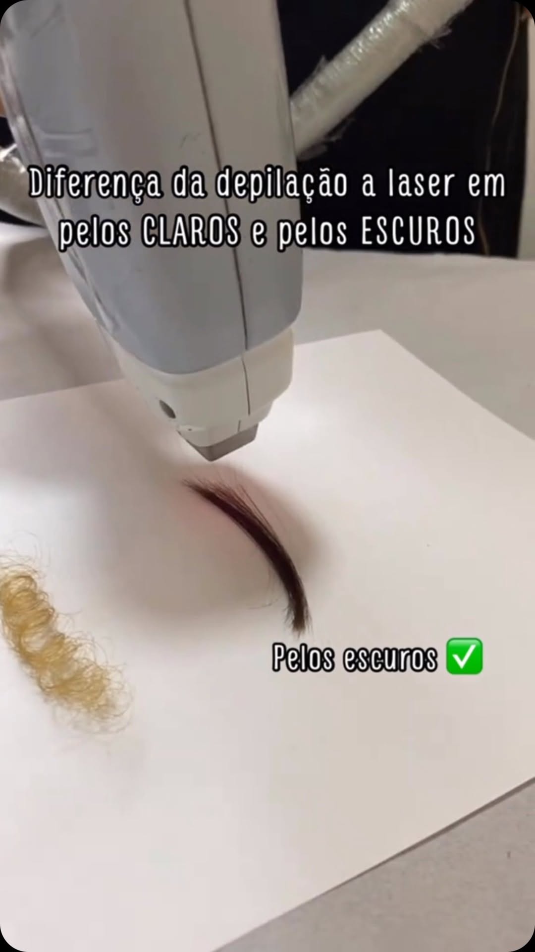 Procedimento estético
